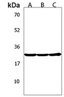TGIF2 Rabbit Polyclonal Antibody