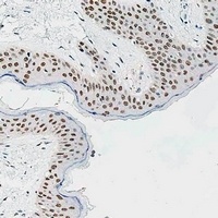 TGIF2 Rabbit Polyclonal Antibody