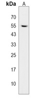 RAP55A Rabbit Polyclonal Antibody