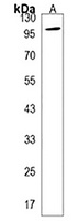 Phospholipase D2 Rabbit Polyclonal Antibody