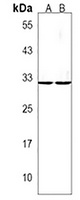 YBX3 Rabbit Polyclonal Antibody