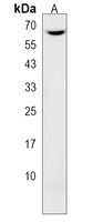 CNOT4 Rabbit Polyclonal Antibody