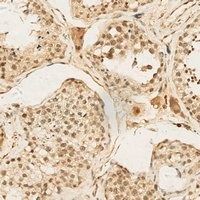 CNOT4 Rabbit Polyclonal Antibody