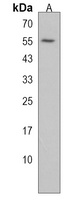 MKK7 Rabbit Polyclonal Antibody