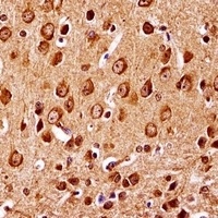 MKK7 Rabbit Polyclonal Antibody