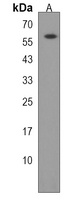 PDIA5 Rabbit Polyclonal Antibody