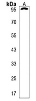 ANKS6 Rabbit Polyclonal Antibody