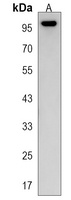 MYLK3 Rabbit Polyclonal Antibody