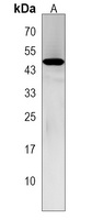 TSPYL5 Rabbit Polyclonal Antibody