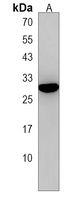 EMP2 Rabbit Polyclonal Antibody