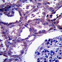 EMP2 Rabbit Polyclonal Antibody