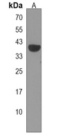GRINA Rabbit Polyclonal Antibody