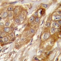 GRINA Rabbit Polyclonal Antibody