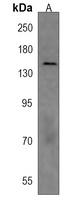 NPC1 Rabbit Polyclonal Antibody