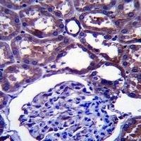 NPC1 Rabbit Polyclonal Antibody