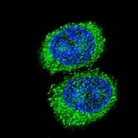 NPC1 Rabbit Polyclonal Antibody
