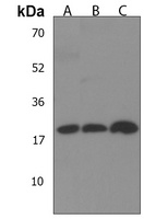 DHFRL1 Rabbit Polyclonal Antibody