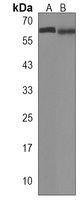 APCDD1 Rabbit Polyclonal Antibody