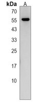 NETO2 Rabbit Polyclonal Antibody
