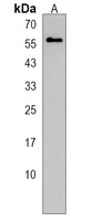 ERO1L Rabbit Polyclonal Antibody