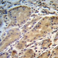 ERO1L Rabbit Polyclonal Antibody