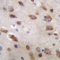 B3GNT1 Rabbit Polyclonal Antibody