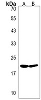BIK Rabbit Polyclonal Antibody