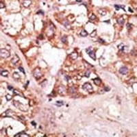 BIK Rabbit Polyclonal Antibody