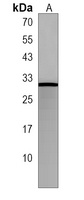 MRAP2 Rabbit Polyclonal Antibody