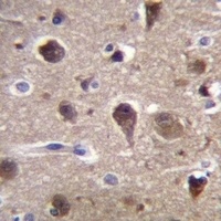 MRAP2 Rabbit Polyclonal Antibody