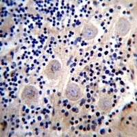 REPS2 Rabbit Polyclonal Antibody