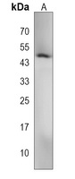 VAT1L Rabbit Polyclonal Antibody