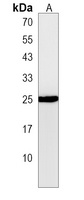 BOK Rabbit Polyclonal Antibody