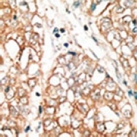 BOK Rabbit Polyclonal Antibody