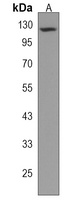 UNC5D Rabbit Polyclonal Antibody