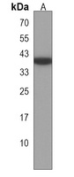 CLMP Rabbit Polyclonal Antibody