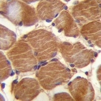 CLMP Rabbit Polyclonal Antibody