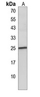 BCL2A1 Rabbit Polyclonal Antibody