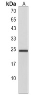 RPL15 Rabbit Polyclonal Antibody