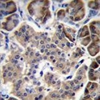 RPL15 Rabbit Polyclonal Antibody