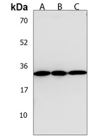 TPM4 Rabbit Polyclonal Antibody