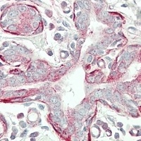 TPM4 Rabbit Polyclonal Antibody