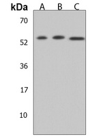 FGFR5 Rabbit Polyclonal Antibody