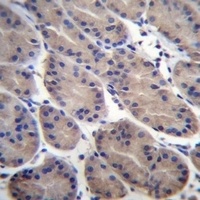 CTTNBP2NL Rabbit Polyclonal Antibody