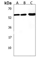 ZNF562 Rabbit Polyclonal Antibody