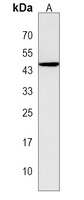 KERA Rabbit Polyclonal Antibody