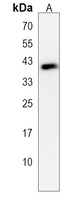 Serpin E2 Rabbit Polyclonal Antibody
