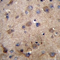 Serpin E2 Rabbit Polyclonal Antibody