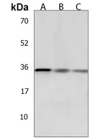 GLIPR1L2 Rabbit Polyclonal Antibody