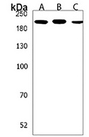 PREX1 Rabbit Polyclonal Antibody